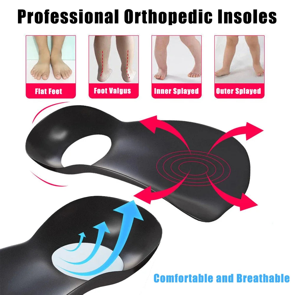 Flat Feet Arch Support Insoles for Shoes Women Men XO-Legs Corrector