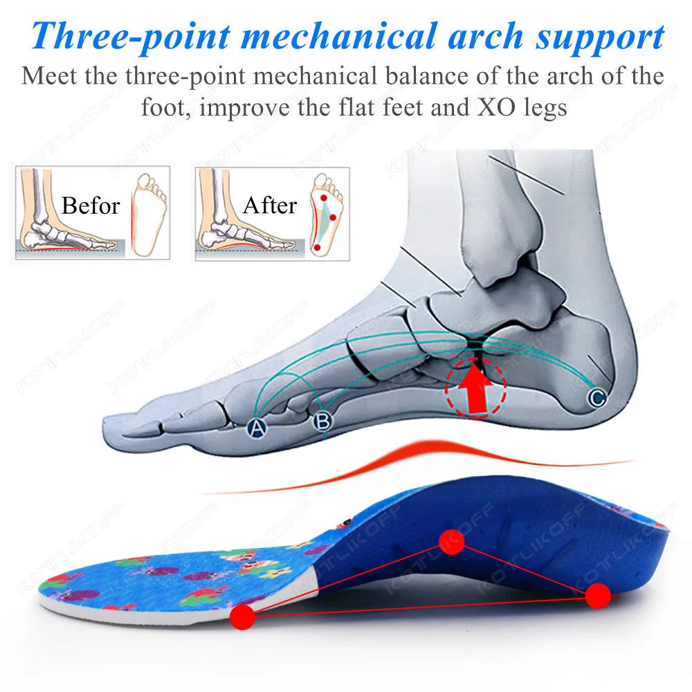 Kids Orthopedic Insoles For Flat Feet High Arch Support Correction OX-Legs