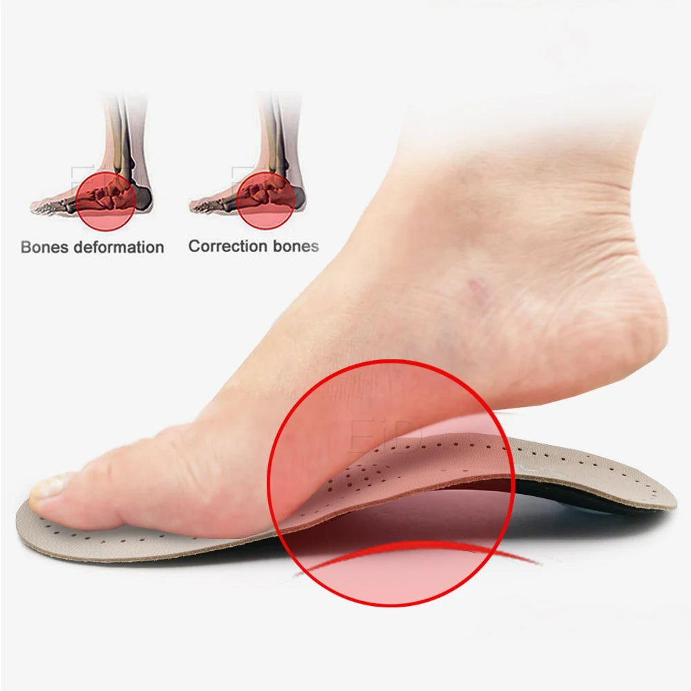 Genuine Leather Orthopedic Insoles for Arch Support