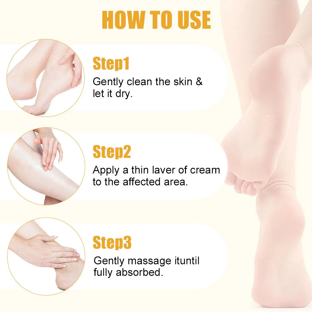 40g Ultra-Hydrating 60% Urea Foot Cream Aloe Vera for Softening Dry Cracked Feet