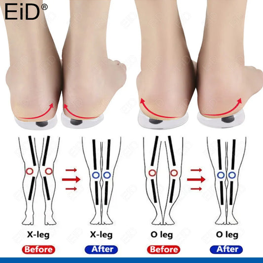 Silicon Insoles O/X Type Legs Knee Varus Correction Heel Pads