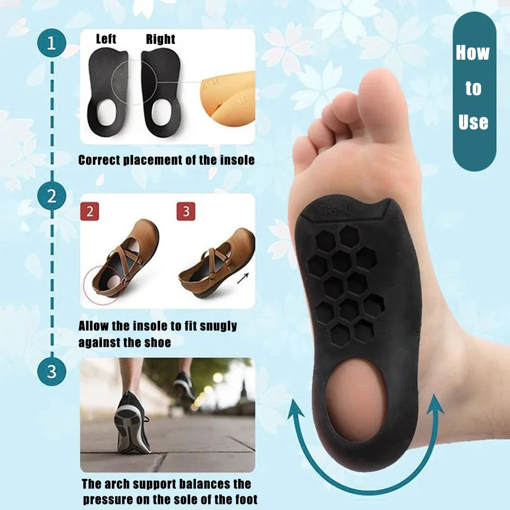 Flat Feet Arch Support Insoles for Shoes Women Men XO-Legs Corrector