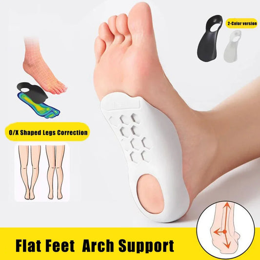 Flat Feet Arch Support Insoles for Shoes Women Men XO-Legs Corrector